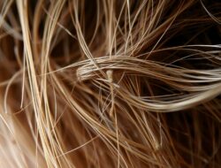 penyebab rambut rontok