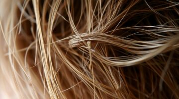 Penyebab Rambut Rontok dan Cara Mengatasinya